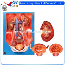 ISO Advanced PVC Anatomical Urinary System Model